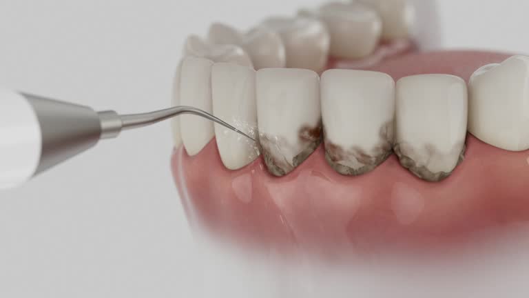 Trusted Dental Implants service in Forest Oaks, NC - Dentist Open Now
